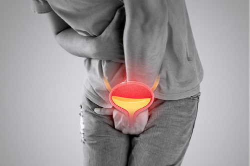 Địa Chỉ Chữa Viêm Tuyến Tiền Liệt Uy Tín Đa Khoa Tây Nguyên