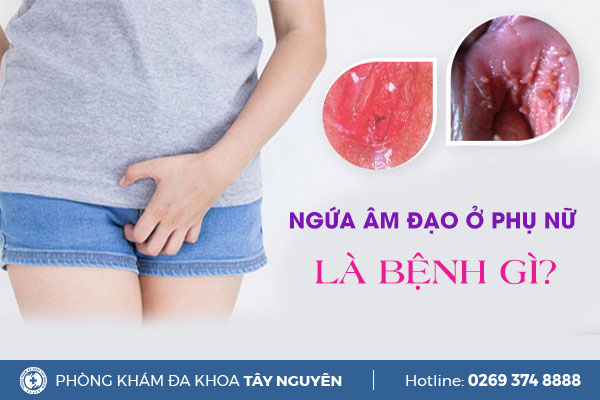 Ngứa âm đạo ở nữ là bệnh gì?