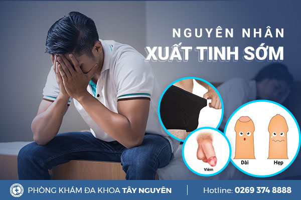 Nguyên nhân xuất tinh sớm Hiểu đúng và chữa trị hiệu quả