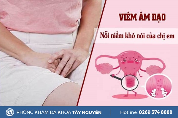 Viêm Âm Đạo - “Kẻ Thù” Của Nhiều Chị Em Phụ Nữ